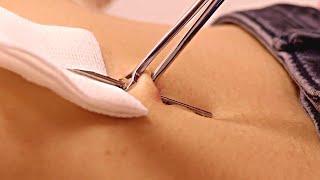 Belly Button (Navel) piercing Procedure, needle poke  | Navel Play