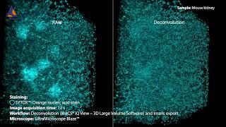 3D image of nucleoli in murine kidney processed with the Deconvolution tool of MACS® iQ View