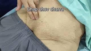 Chap chov churra  Yotal simptomi