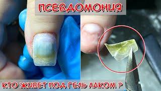 Green nail under gel  / Pseudomonia on nails