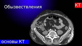 Лучевая диагностика | обызвествления на КТ : кальцинат, констриктивный перикардит, дерматополимиозит