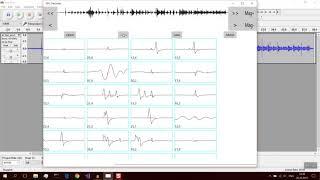 How to remove audio clicks automaticaly using GPU Declicker