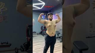 DAY 106 | Surgery | #chestfat #fatloss #fitness #motivation #yt #shorts #weightloss #viral #ytshorts