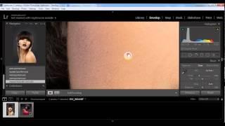 Как убрать прыщи в Lightroom  инструмент Spot removel