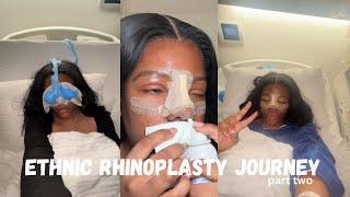 ETHNIC RHINOPLASTY | DR. BORA OK | part two