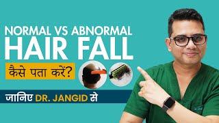 Normal vs Abnormal Hair Fall | Differences & Treatments | Hair Fall vs Severe Hair Loss (Shedding)