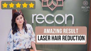 LASER HAIR REDUCTION at RECON II MS.NEHA SINGH