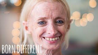 The Woman Who Ages Too Fast | BORN DIFFERENT