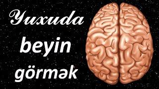 Yuxuda beyin görmək  Qısa Yuxuyozma