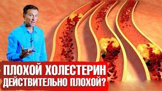 Какой холестерин - плохой? ‍️ ЛПНП - не плохой?! Как снизить холестерин