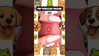 Wow! #youtubeshorts #pimplepopping #pimple #pimples #youtube #shortsfeed #shortvideo #shorts #short