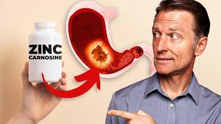 Why Zinc Carnosine REALLY Fixes Ulcers and Gastritis