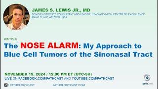 #ENTPATH The NOSE ALARM: My approach to Blue Cell Tumors of the Sinonasal Tract