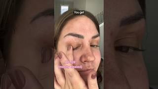 DIY Eyelid Lift - Surgeon Reacts