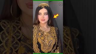 Why Dubai gold is so cheap? #shorts #treendig