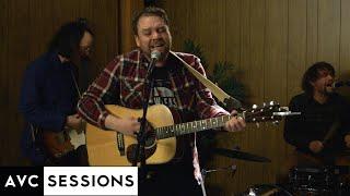 Frightened Rabbit performs "Head Rolls Off" | AVC Sessions