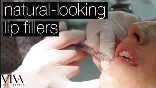 Natural-Looking Lip Fillers with Dr Rupert Critchley | VIVA SKIN CLINICS