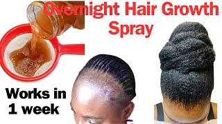 Overnight Hair Growth Spray You Need To Start Using If Your Hair Isn't Growing. Reverses Baldness