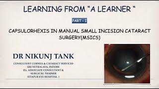 Learning from a Learner- Part 1- Capsulorhexis in SICS : Dr Nikunj Tank