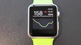 Nightguard (formerly known as Scoutwatch) Apple Watch App for the Nightscout Backend