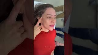 Caso transformador de harmonização facial pela Touche Clinic!