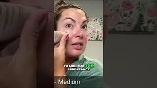 Get Glowing Skin: Makeup Tutorial for Dry Skin