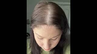 UniWigs Remy Human Hair Topper, 7.5"x7.5" Base Size for Women Hair Loss or Thin Hair