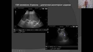 НАУЧНАЯ ШКОЛА «Лучевая диагностика в гастроэнтерологии». Часть 1