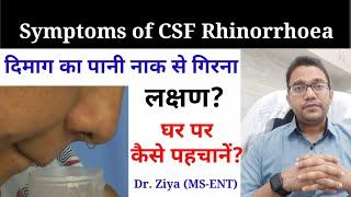 CSF Rhinorrhea घर पर कैसे पहचानें? Naak se Pani aana. Leaking of brain fluid through nose.