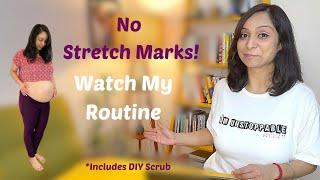 How I Prevented 90% Stretch Marks During Pregnancy: Tips & Tricks That Actually Work!