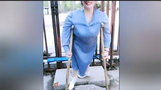 The beautiful woman with polio walks on crutches #polio_woman #polio