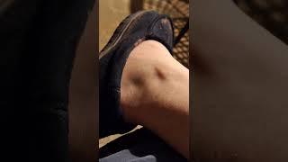 vein beating in ankle (cool as heck)