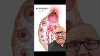 Understanding Pain Perception: A Complex Journey #pain #anatomy