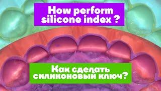 How perform silicone index for mock-up? / Как сделать силиконовый ключ?