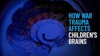 How War Trauma Affects Children's Brains