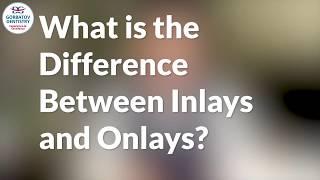 What is the Difference Between Inlays and Onlays?