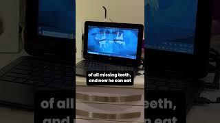 Dental Implant Treatment - Malik Dental Associates - Dr.Numan Waris #dentalimplants