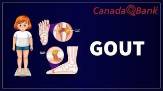 Gout