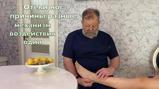 Отеки ног: причины разные, механизм воздействия один