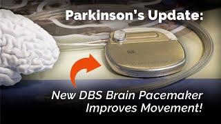 New DBS Brain Pacemaker Improves Movement for People with Parkinson's