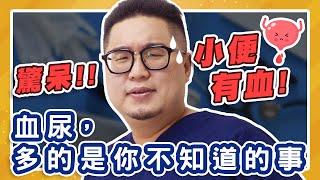 【關於血尿】驚呆！小便有血！血尿，多的是你不知道的事| 石攝性也 | 泌尿科陳鈺昕醫師