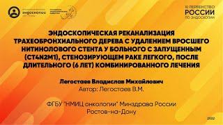 Эндоскопическая реканализация трахеобронхиального дерева с удалением вросшего нитинолового стента