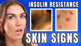 How Insulin Resistance Changes Your Face (and Body)