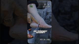 Bound by Beauty: The Painful Legacy Of Foot Binding in Ancient China