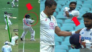 Mitchel Starc Badly Brokes Rishabh pants Helmet Today match | Rishabh Pant Batting Today