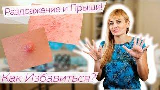 Раздражение и Прыщи после ЭПИЛЯЦИИ / КАК ИЗБАВИТЬСЯ?