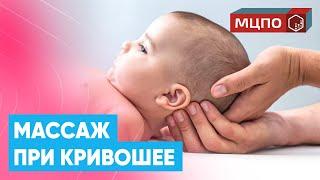 Массаж ребенку при КРИВОШЕЕ | Обучение массажу в МЦПО