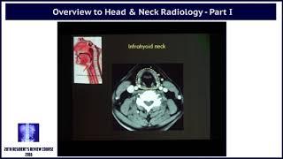 Overview to Head & Neck Radiology Part I