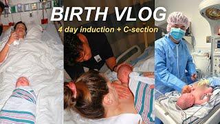 BIRTH VLOG *RAW*  4 day failed induction ending in emergency C-section | IVF live birth