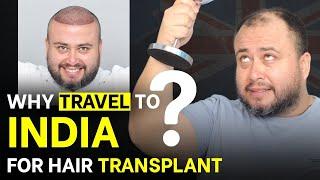 FUE Hair Transplant (HX-MILQ) | Best Cost & Results of FUE Hair Transplant